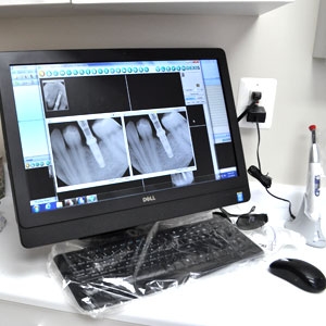 Digital dental x-ray in Dr. Mercando's office